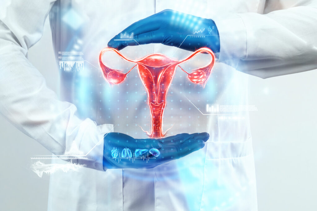 treatment of pcos with homeopathy medicine